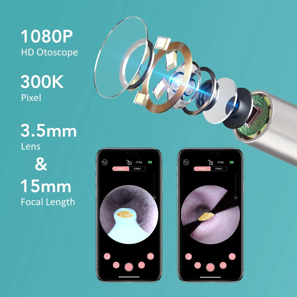 Visual Ear Cleaner with 1080P Camera & Tweezers | All Ages