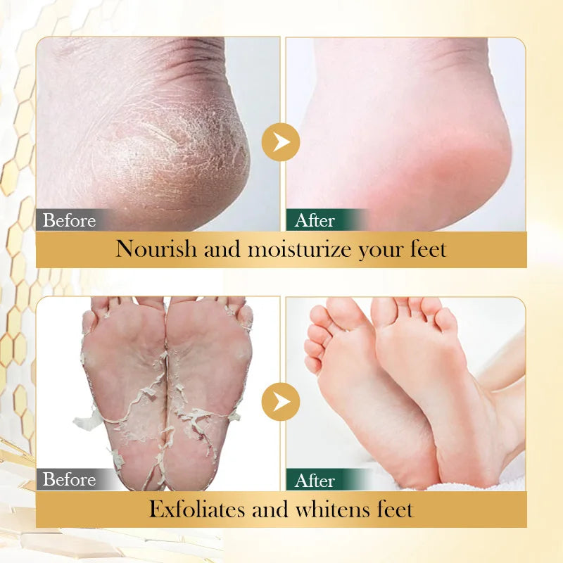 BIOAOUA Vitamin E & Manuka Honey Foot Mask | Deep Moisture