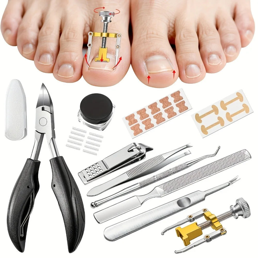 129-Piece Nail Embedding Tool Set – Pliers, Lifter & Cuticle Kit