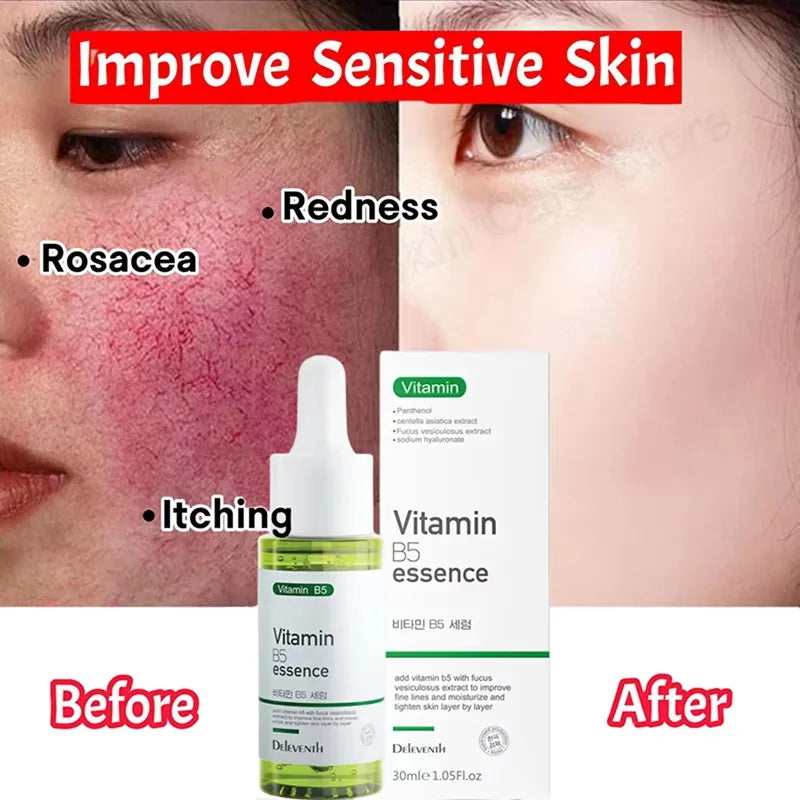 SADOER Calming Face Serum – Sensitive Skin & Pore Minimizer