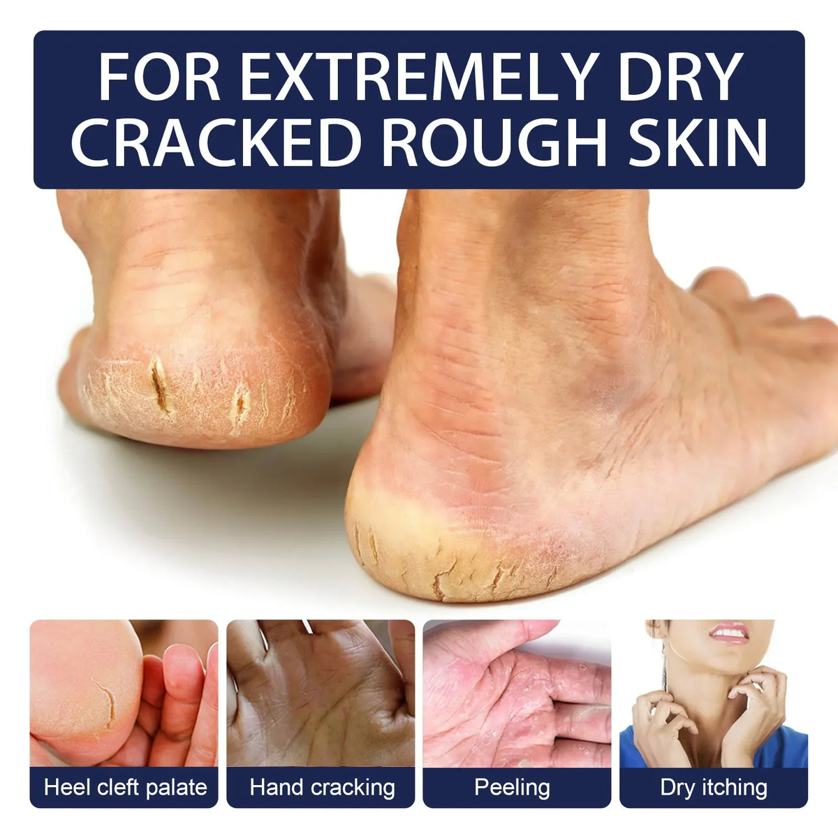 Jaysuing Heel & Hand Repair Cream | Nourishing Moisture 30g