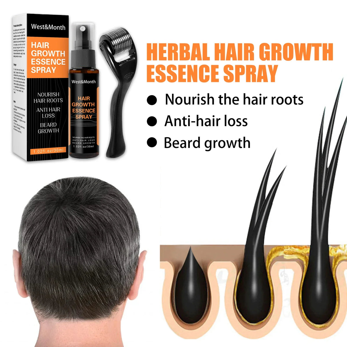 Hair Thickening Scalp Spray – Polygonum & Ginger Nourishment