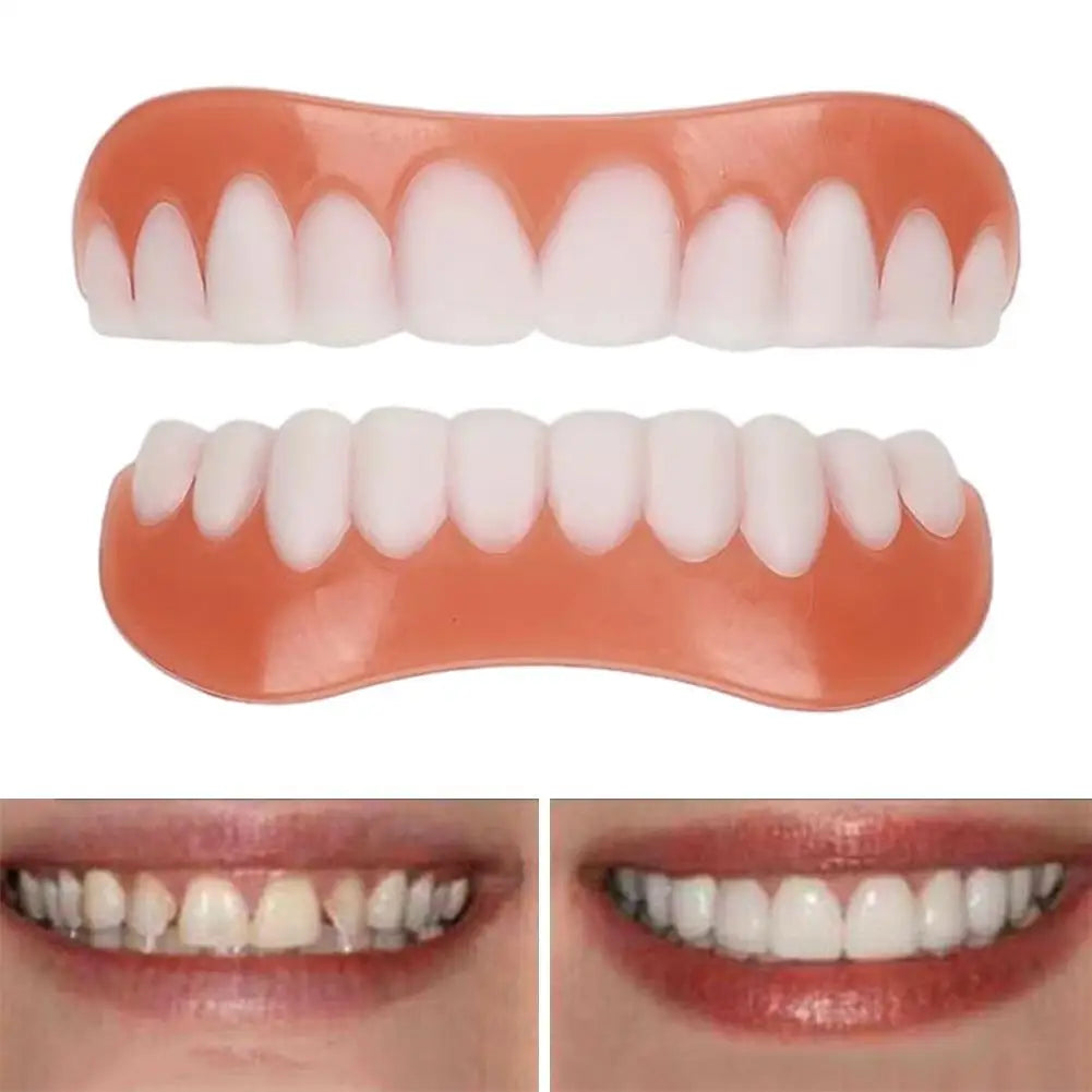 Soft Silicone Denture Kit – Upper & Lower Teeth Liner Set