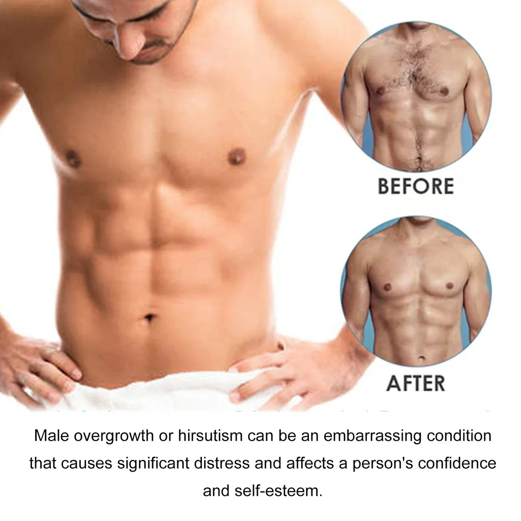 East Moon Men's Hair Removal Cream – Body & Beard 60ml