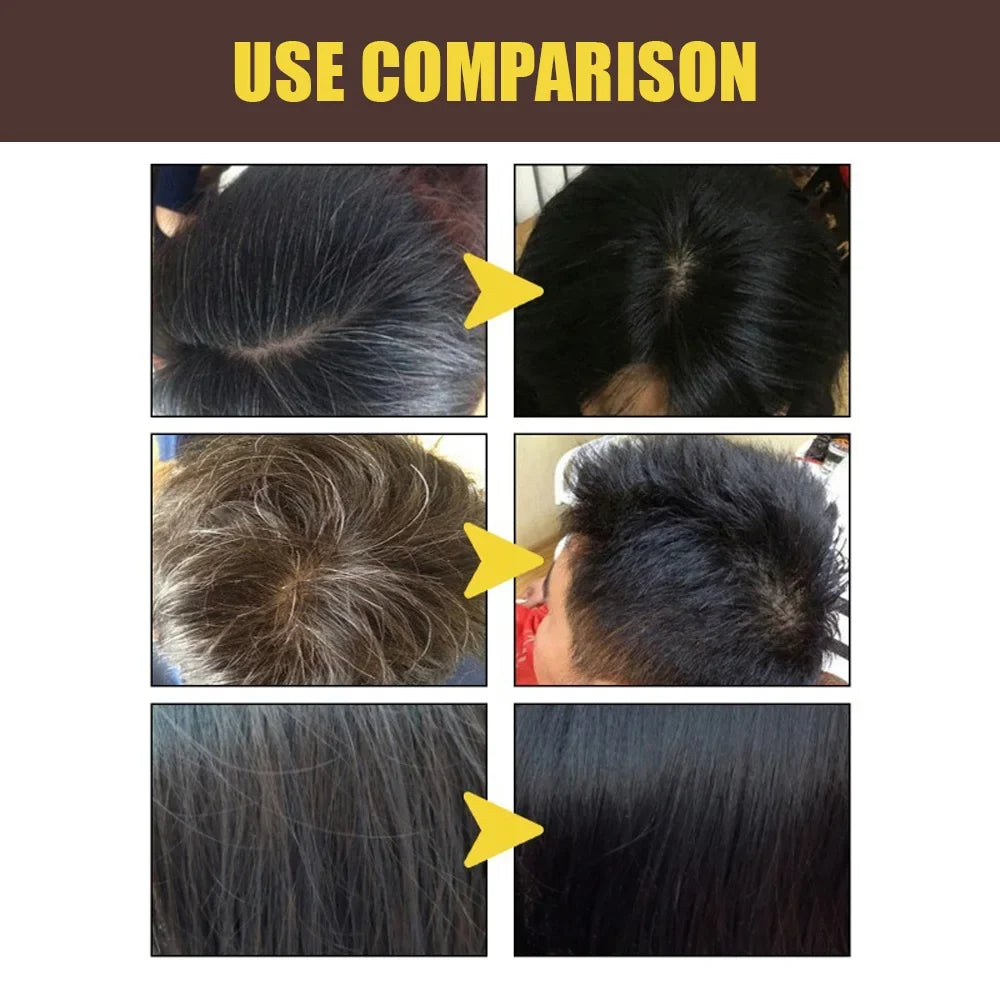 3-in-1 Dark Brown Hair Color Shampoo | Herbal Formula 100ml