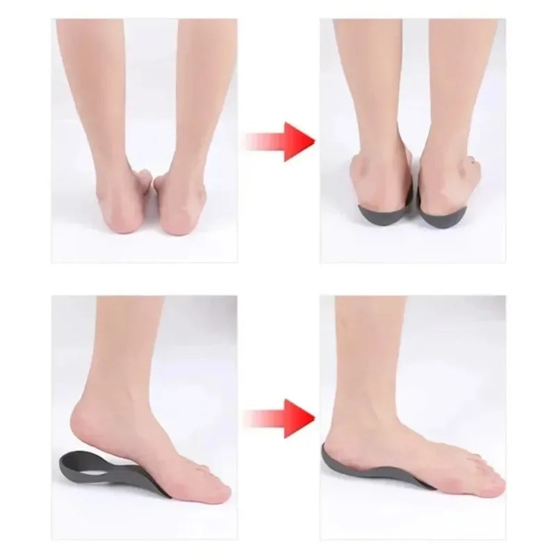 Arch Support Orthotic Insoles for Flat Feet & Plantar Fasciitis