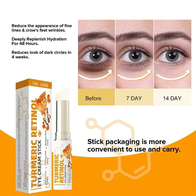 SADOER Retinol Eye Cream – Brighten, Firm & Hydrate