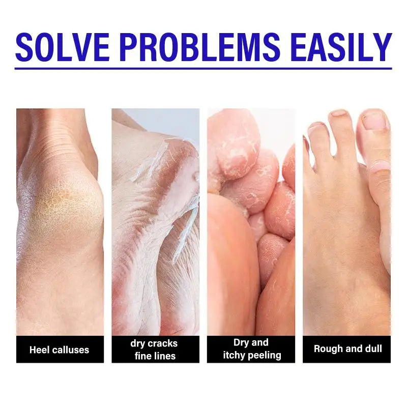 XIMONTH Heel Cream – Moisturizing Exfoliating Foot Cream 40g