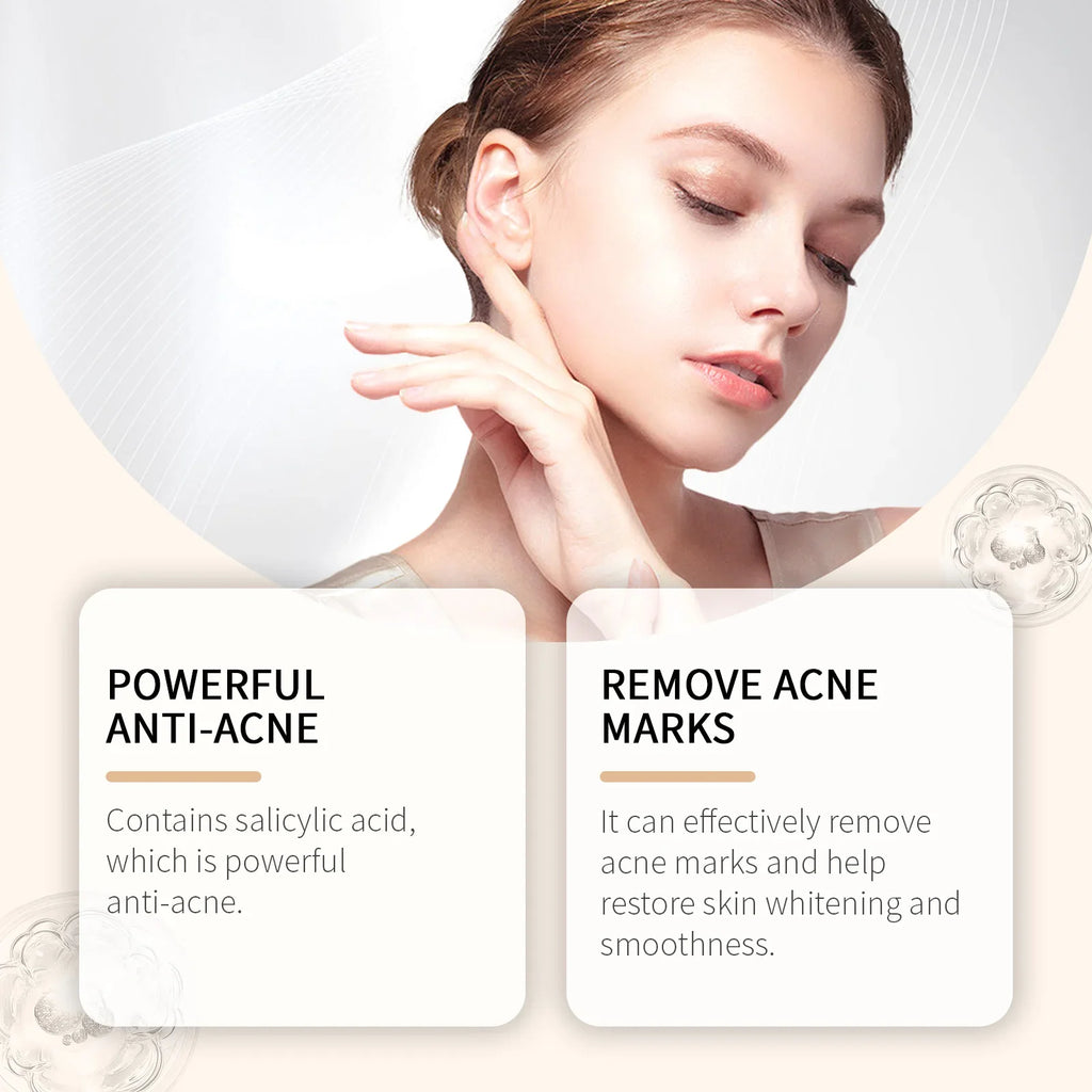 Hoygi Salicylic Acid Acne Serum – Pores, Blackheads & Oil