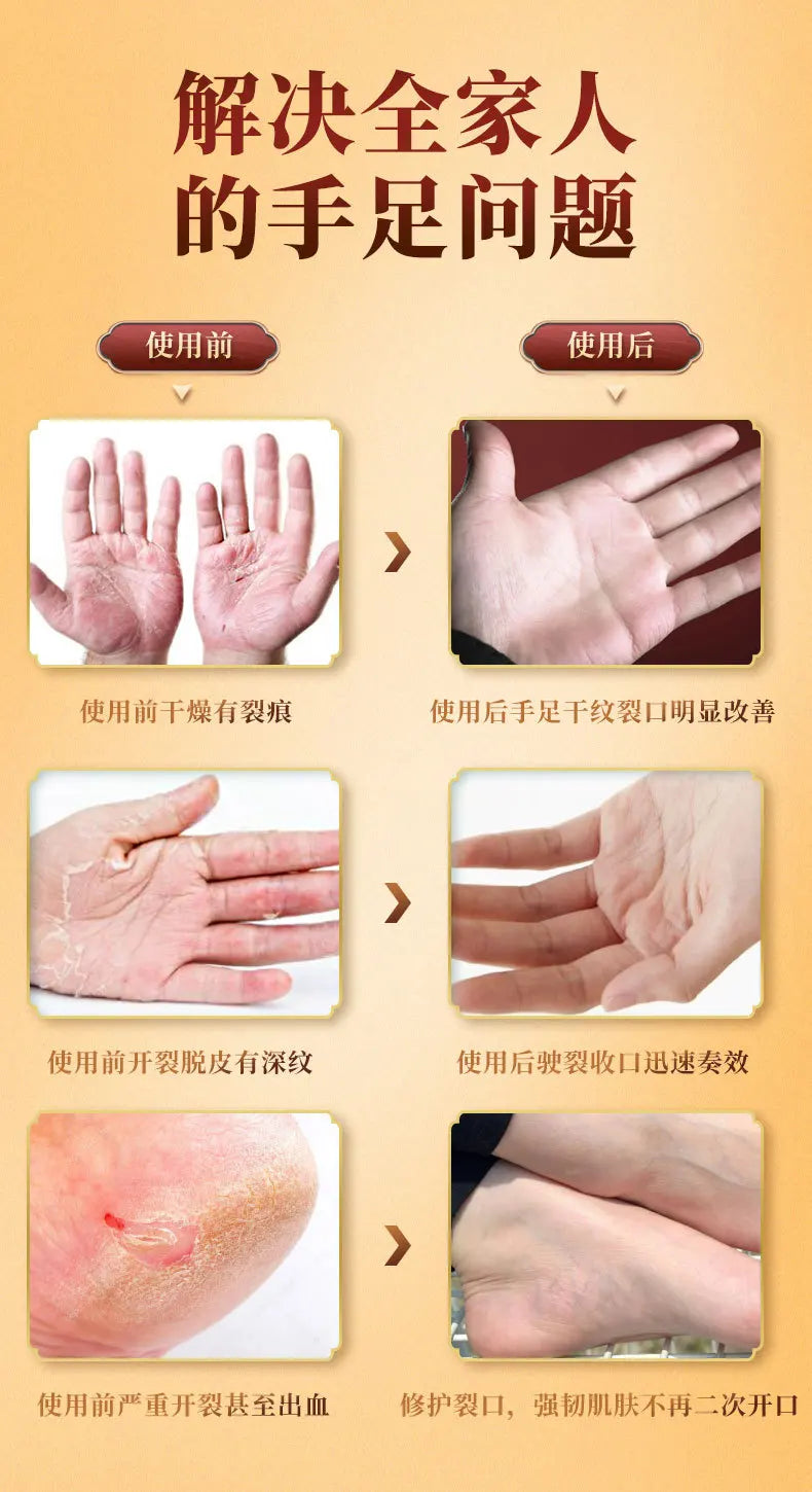 Jintai Kangma Horse Oil Cream – Hand & Foot Moisturizer 80g