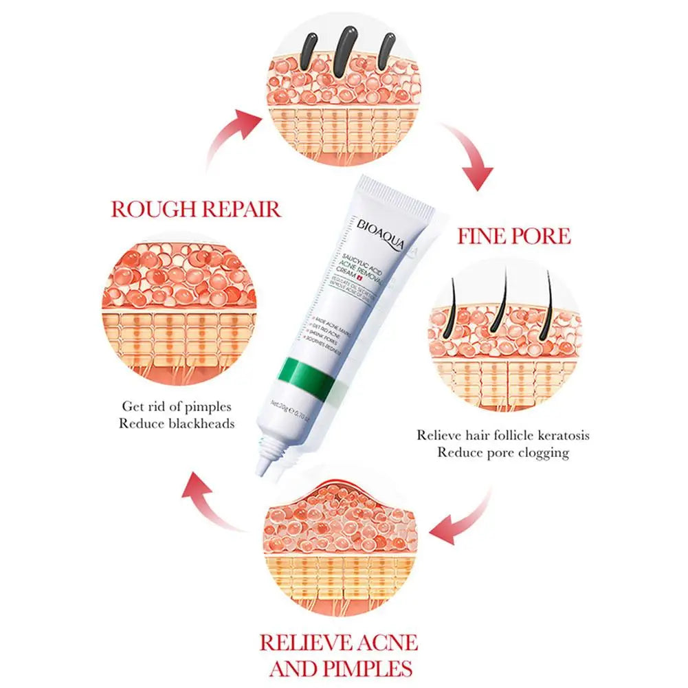 BIOAQUA Salicylic Acid Acne Cream – Pore Minimizer & Oil Control