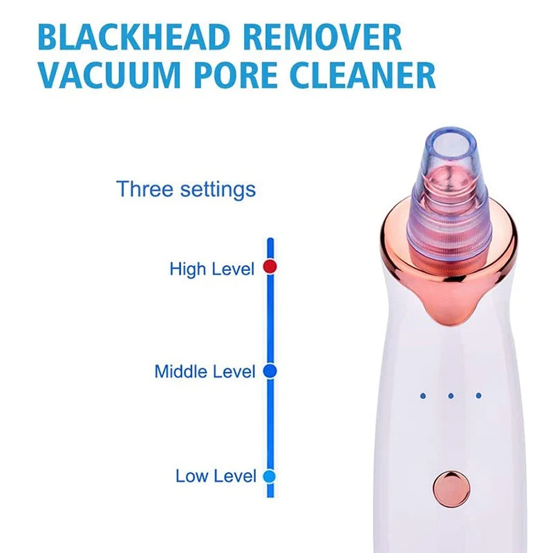 Blackhead Remover Vacuum Pore Cleanser – USB Rechargeable