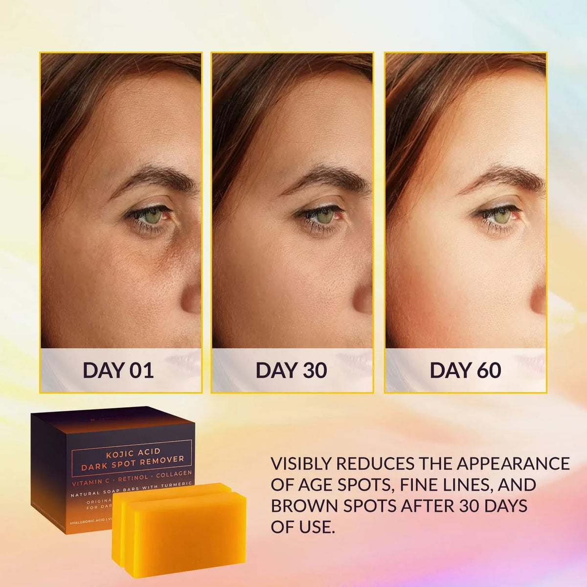 Kojic Acid Brightening Soap – Dark Spot Remover & Cleanser