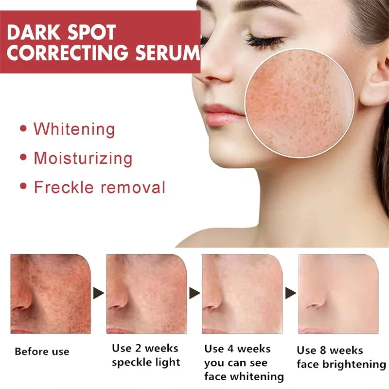 Nicotinamide Brightening Cream – Dark Spot & Tone Corrector