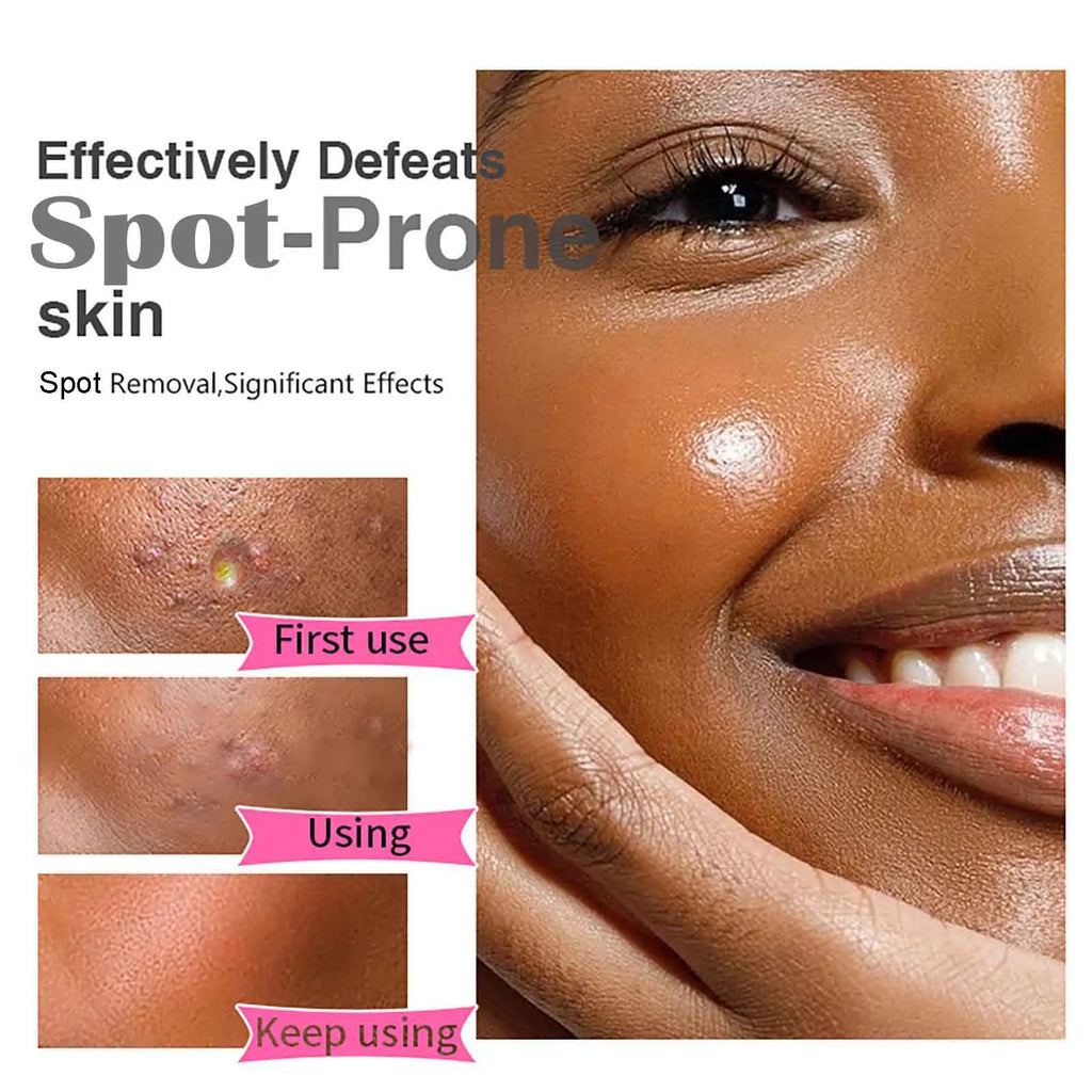 AILKE Brightening Face Cream – Blemish & Dark Spot Cream 50ml