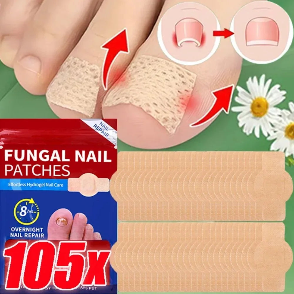 Nail Repair Patches – Ingrown Toenail & Nail Care Stickers