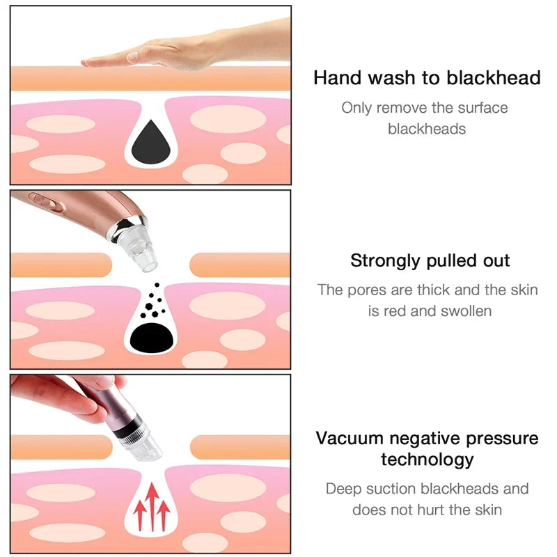 Mini Water Jet Facial Cleansing Machine – Pore & Skin Care