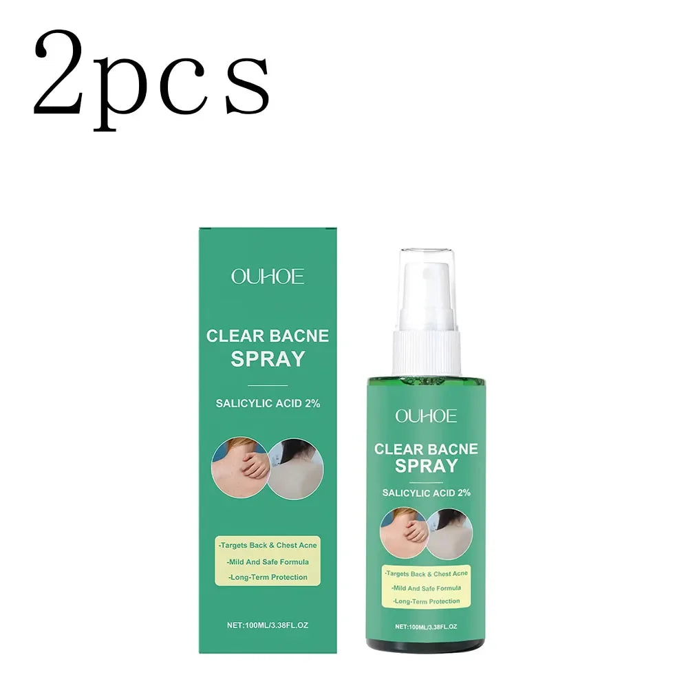 Back Acne Treatment Spray – Oil Control & Soothing Body Spray