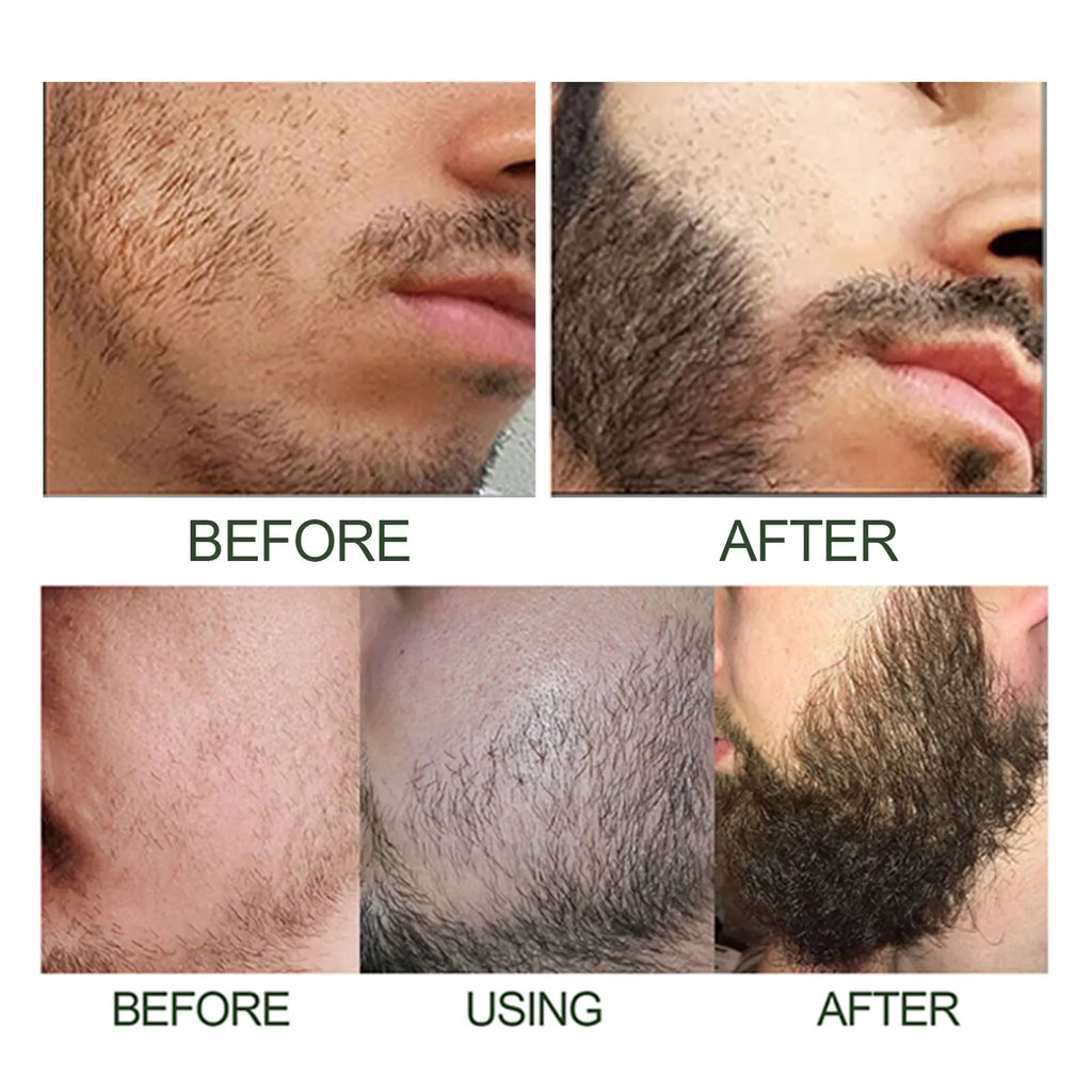 Men's Beard Care Essence Set – Nourishing 60ml Beard Oil