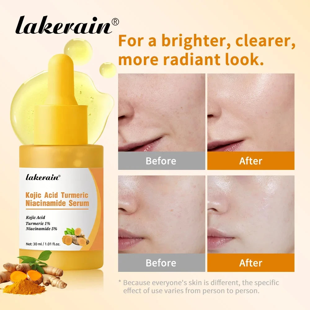 Kojic Acid Turmeric Niacinamide Brightening Glow Serum 30ml