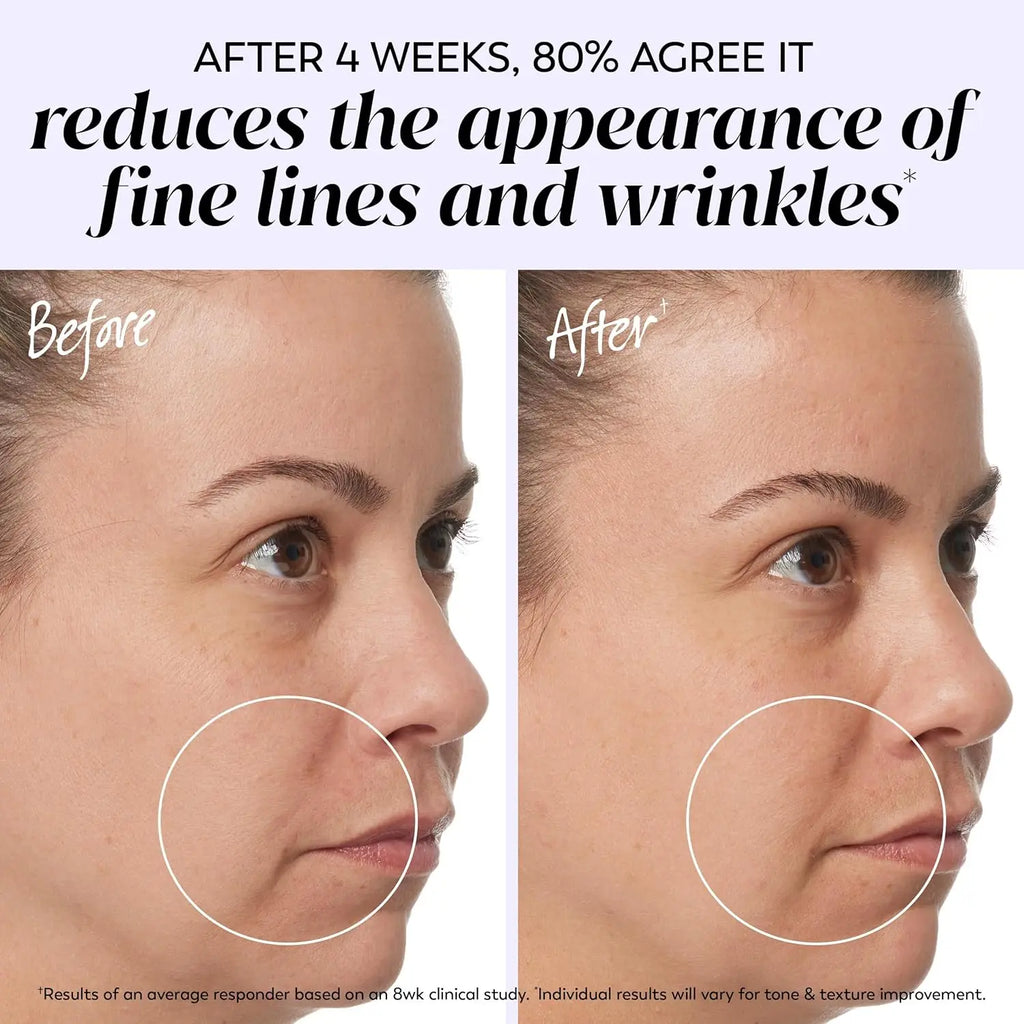 Layered Pore Bacteria Wrinkle Remover Face Cream Firming Lifting Anti