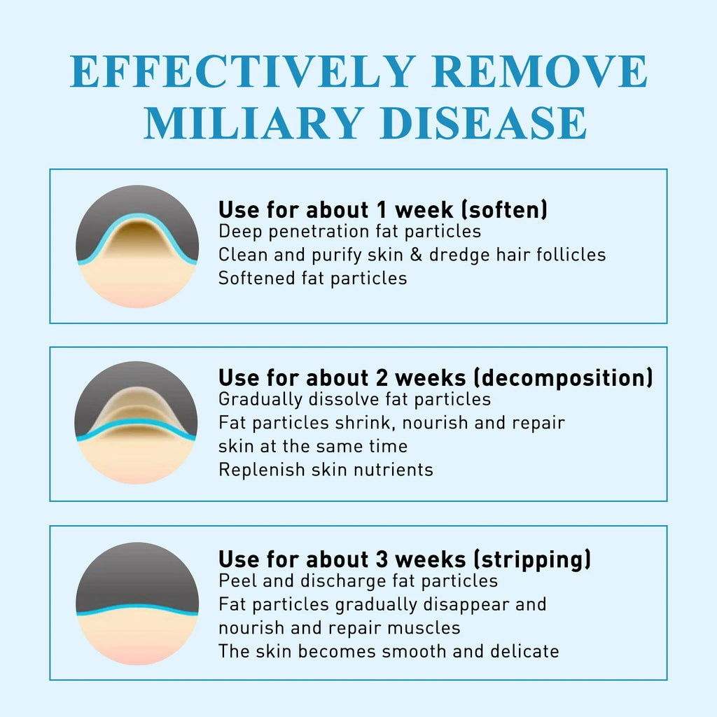 South Moon 144pc Hydrocolloid Blemish Patches | Salicylic & Cica