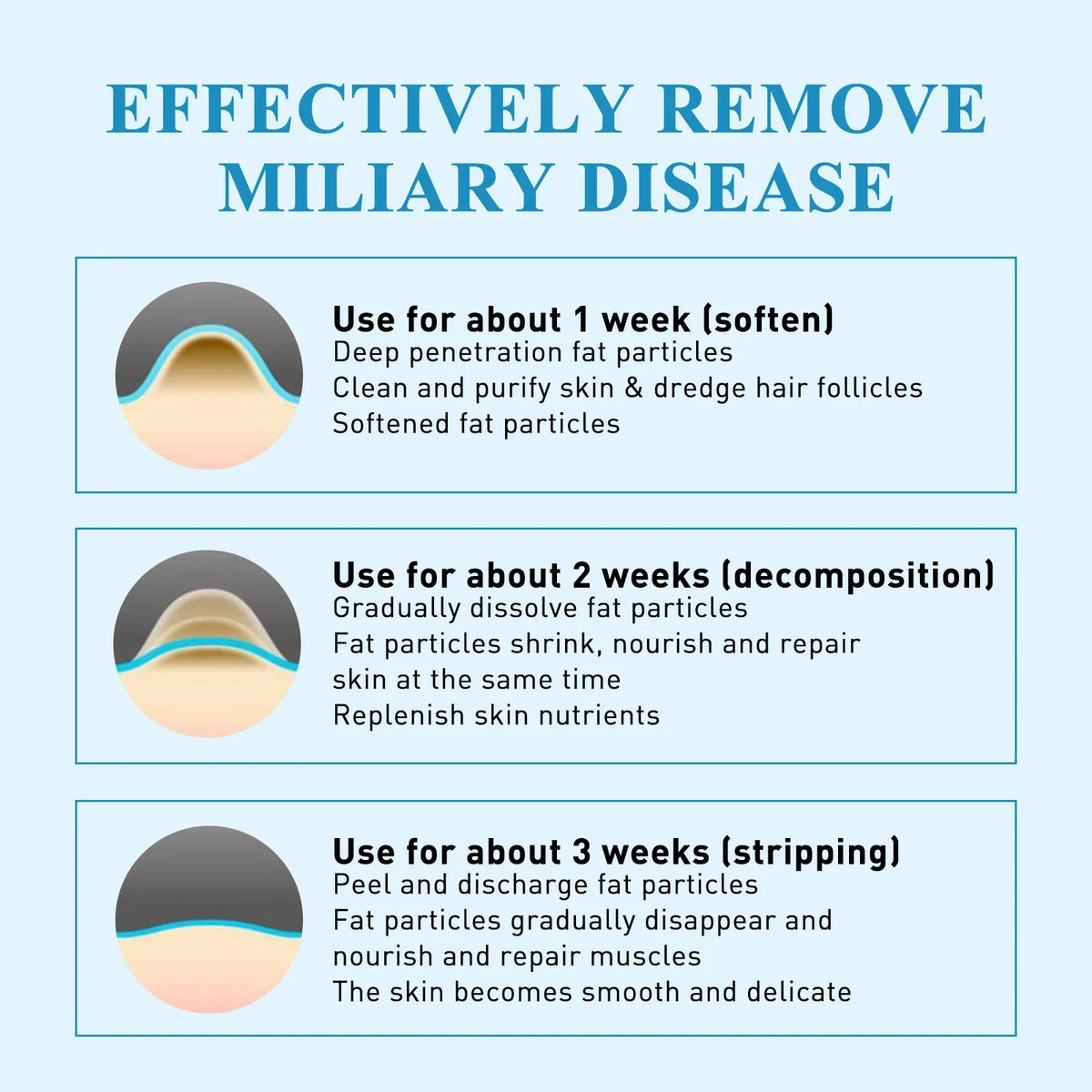 South Moon 144pc Hydrocolloid Blemish Patches | Salicylic & Cica