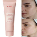 Revitalize Skin Fruit Acid Peeling Gel Facial Cleansing Exfoliating