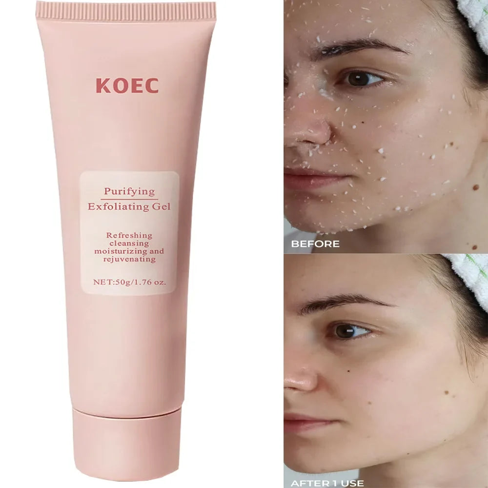 Revitalize Skin Fruit Acid Peeling Gel Facial Cleansing Exfoliating