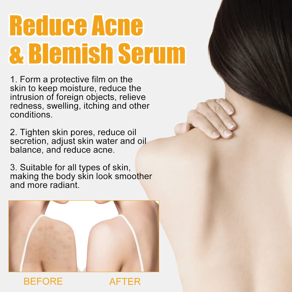 Jaysuing Body & Face Clarifying Serum – Fade Spots 50ml
