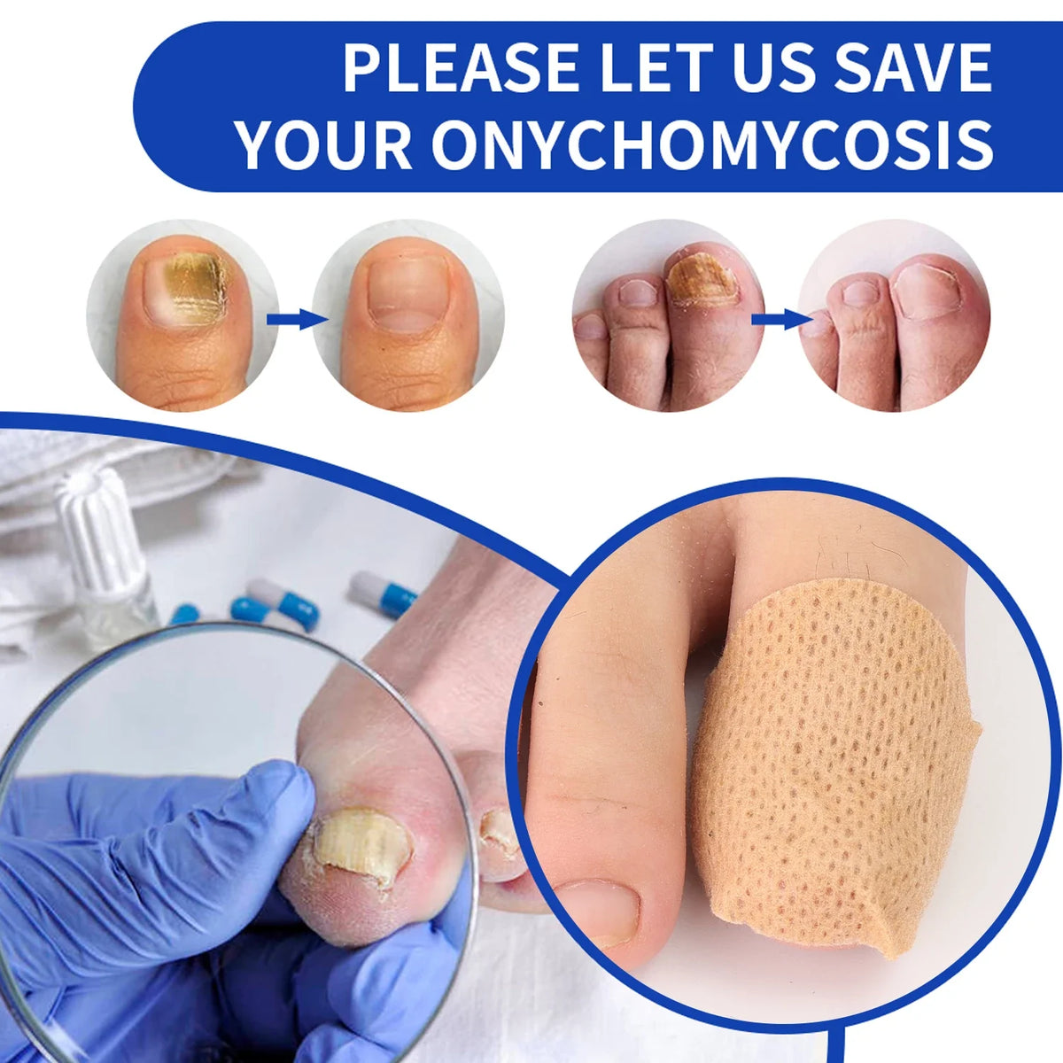 Nail Repair Patches – Toenail Care & Ingrown Correction Stickers