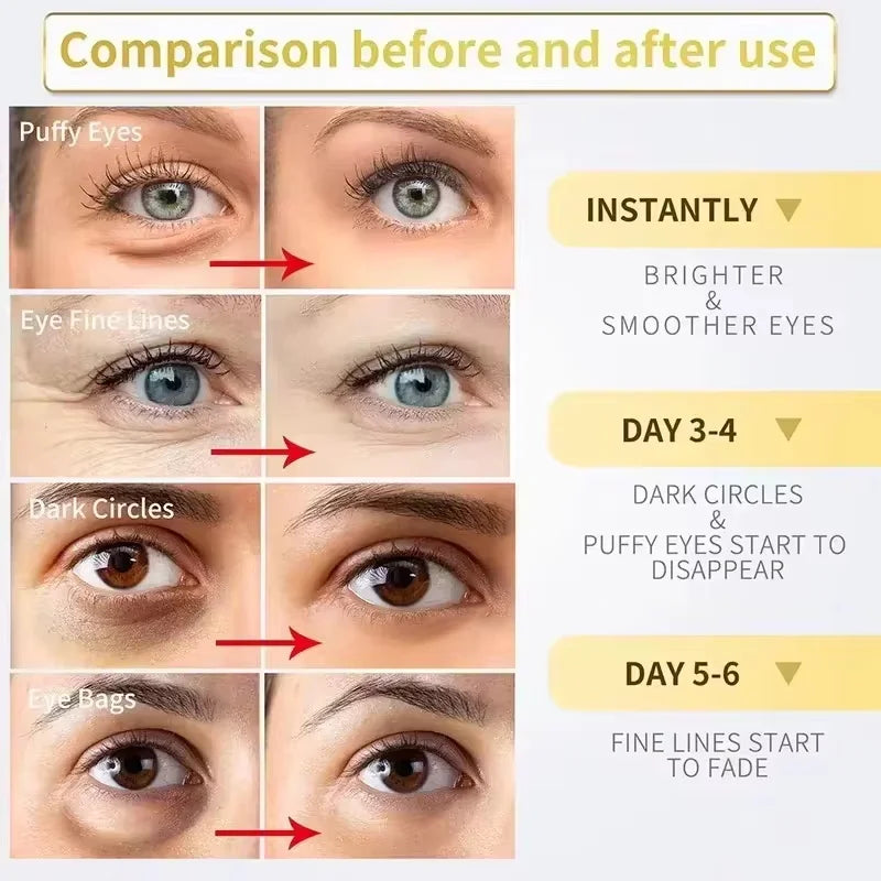 Eelhoe Retinol Eye Cream Stick – Firm, Brighten & Hydrate