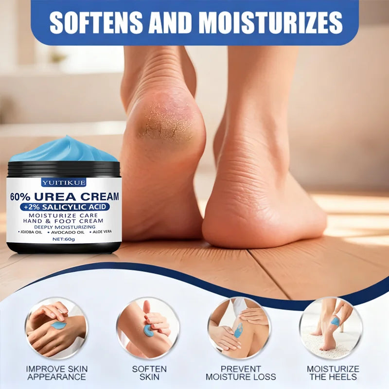 YUITIKUE 60% Urea Foot Cream 60g – Soft Heels & Smooth Skin