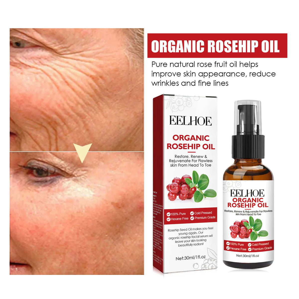 EELHOE 30ml Organic Rosehip Oil Face Serum – Hydrating & Firming