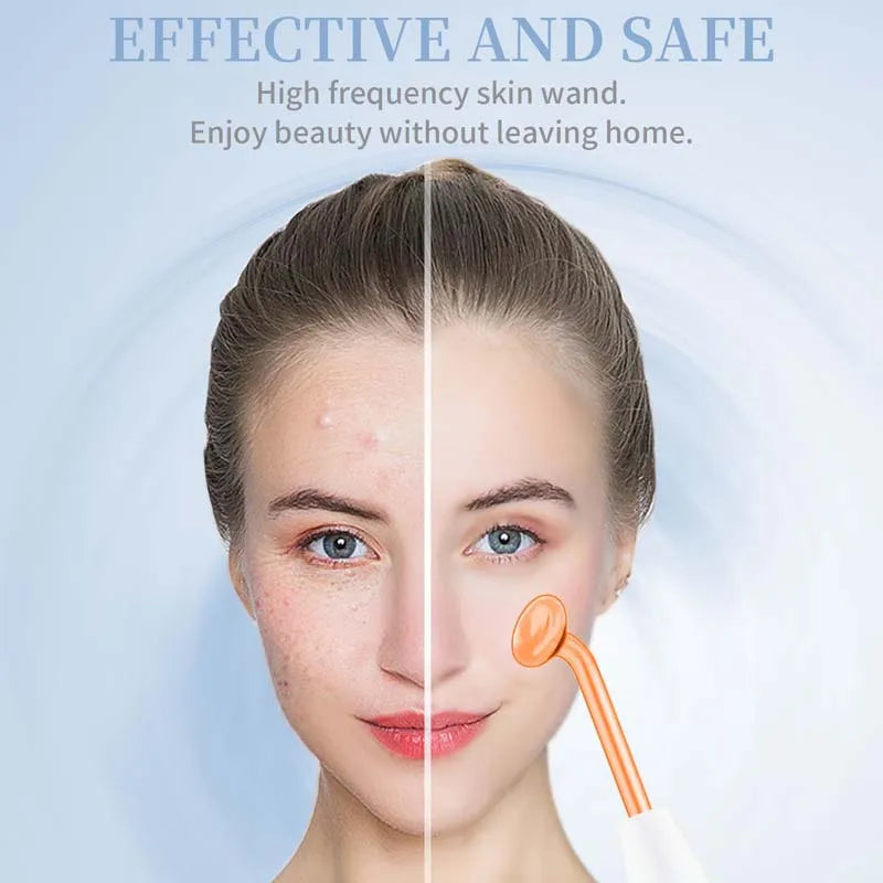 High Frequency Electrotherapy Skin Device | Pro-Grade Wand
