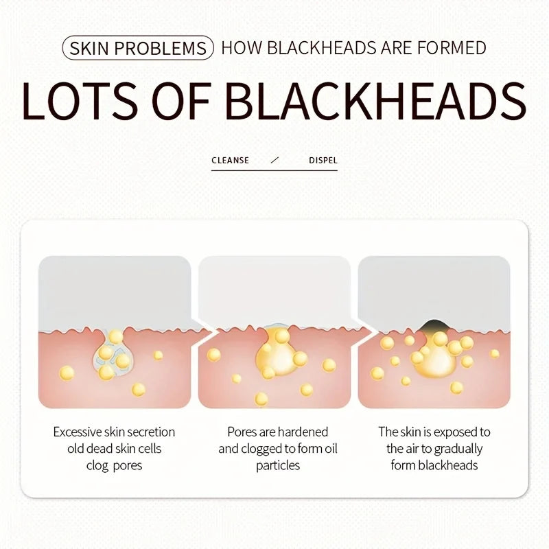3-Step Blackhead Removal Nose Patch – Cleanse & Refine Pores