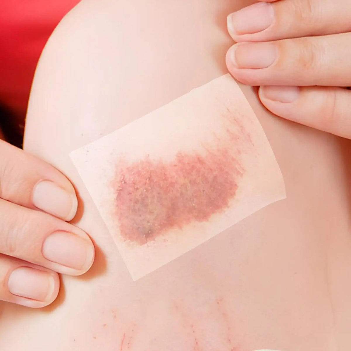 Hydrocolloid Roll Waterproof Pimple Patches Absorbent Flexible Tape