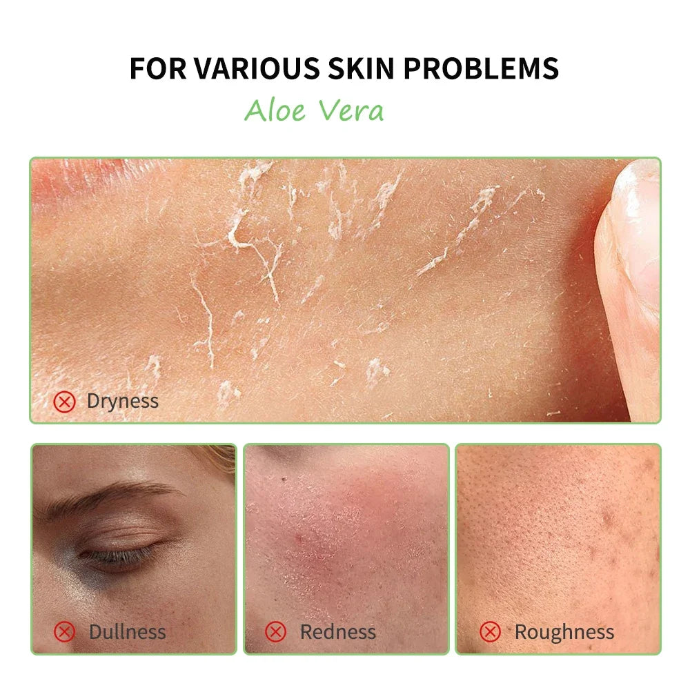 Aloe Vera 6-Piece Skin Care Set – Hydrating & Brightening Kit
