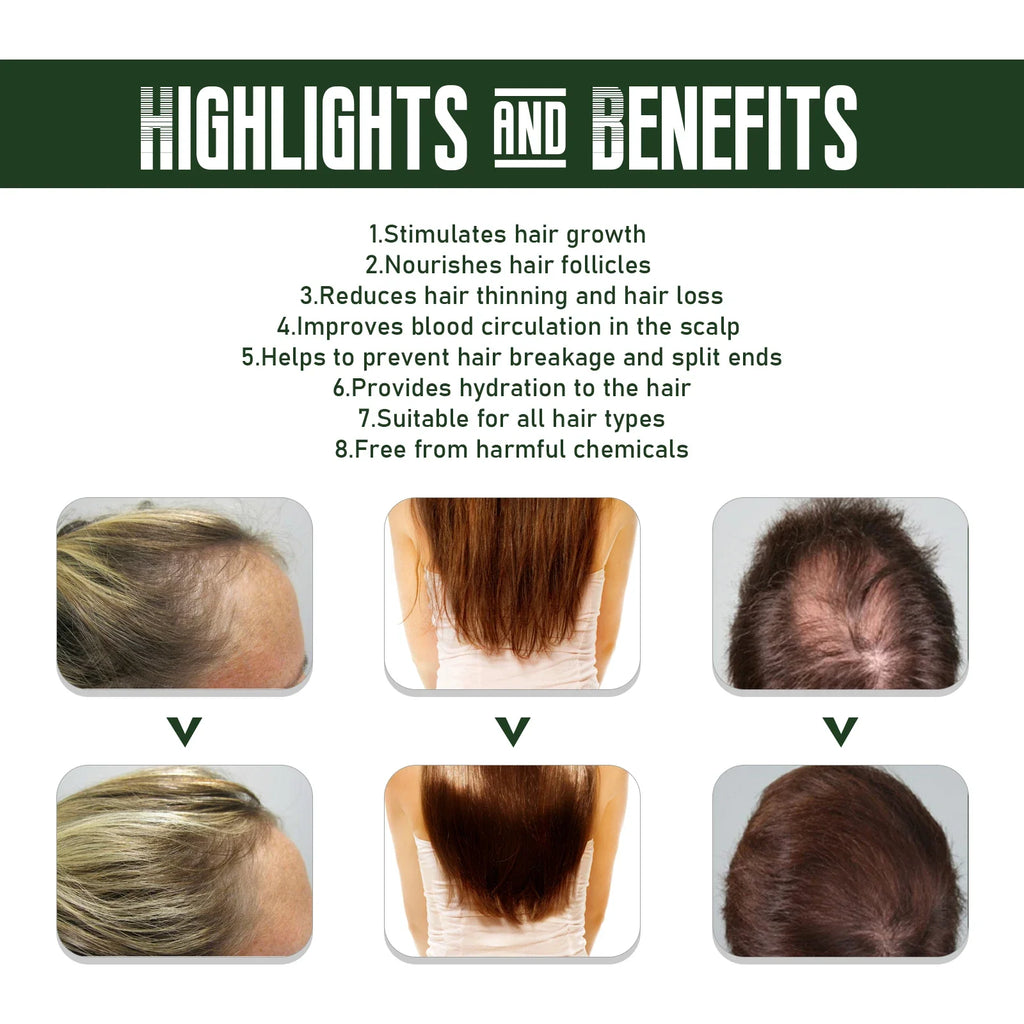 EELHOE Ginger Hair Spray – Prevent Hair Loss & Thicken Hair