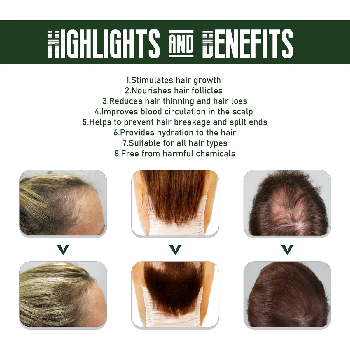 EELHOE Ginger Hair Spray – Prevent Hair Loss & Thicken Hair