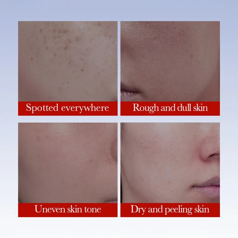SADOER Brightening Face Cream – Dark Spot & Anti-Aging