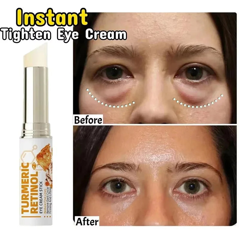 SADOER Retinol Eye Cream – Brighten, Firm & Hydrate