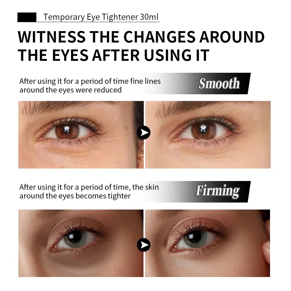 Instant Eye Tightener Cream – Firm, Lift & Smooth Skin | 30ml