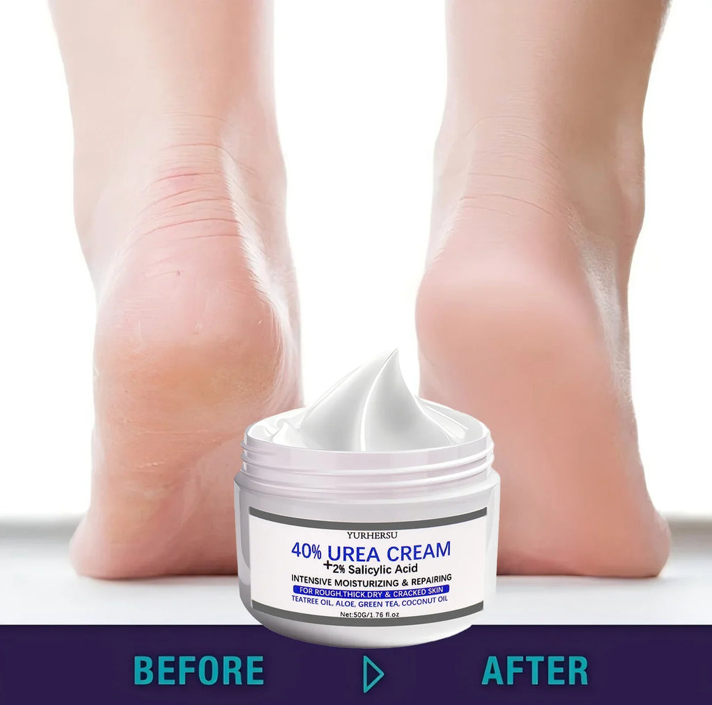 YURHERSU 40% Exfoliating Foot Cream for Dry Cracked Heels 50g