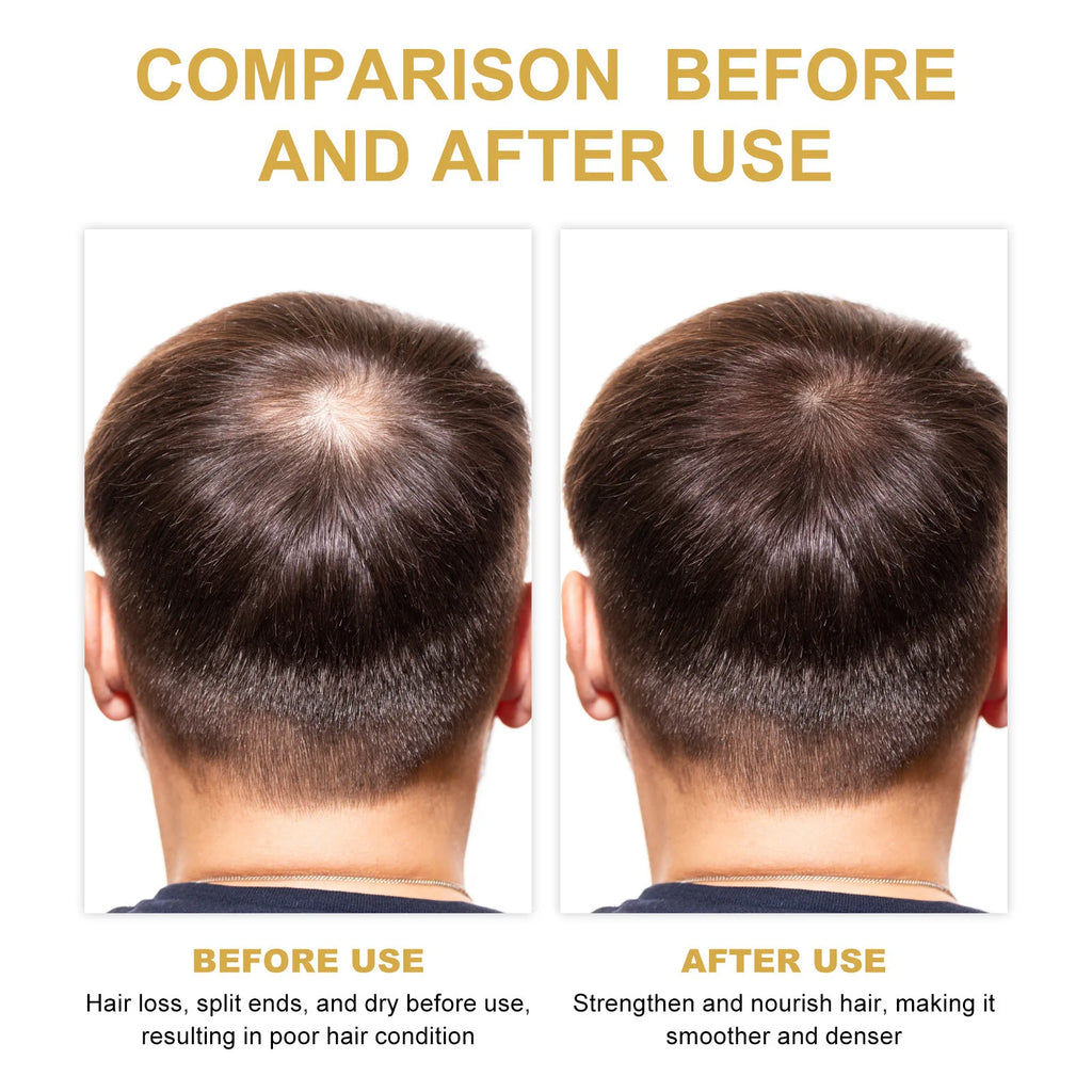 Eelhoe Rosemary Hair Care Series – Shampoo, Conditioner & Oil