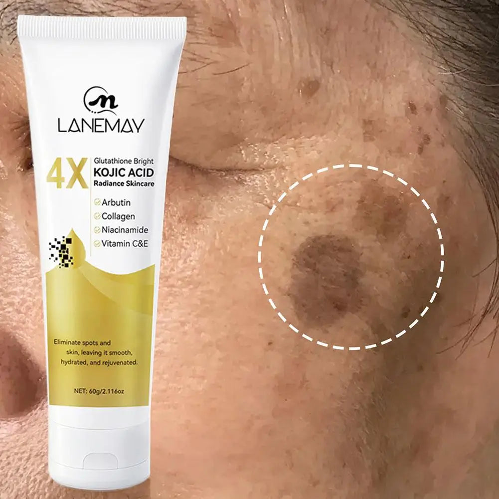 Glutathione Kojic Acid Brightening Face Cream – Dark Spot Cream