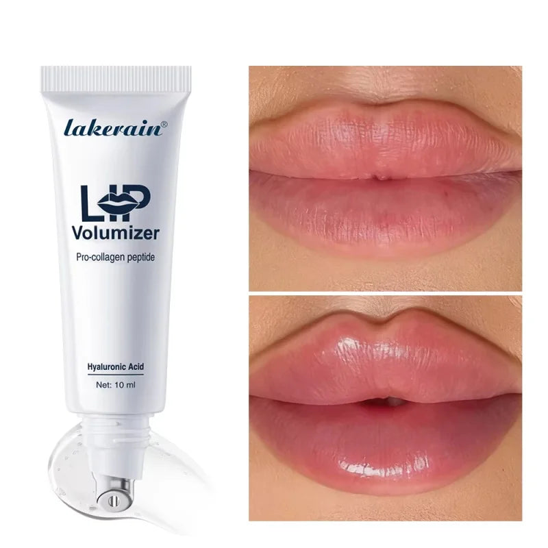 Lip Plumping Gloss with Hyaluronic Acid – Fuller, Glossy Lips