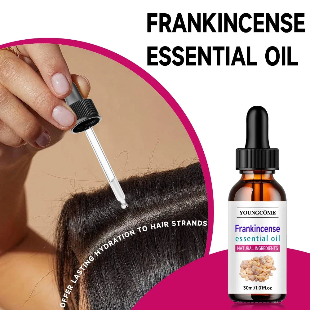 Frankincense Essential Oil – Scalp, Hair & Aromatherapy