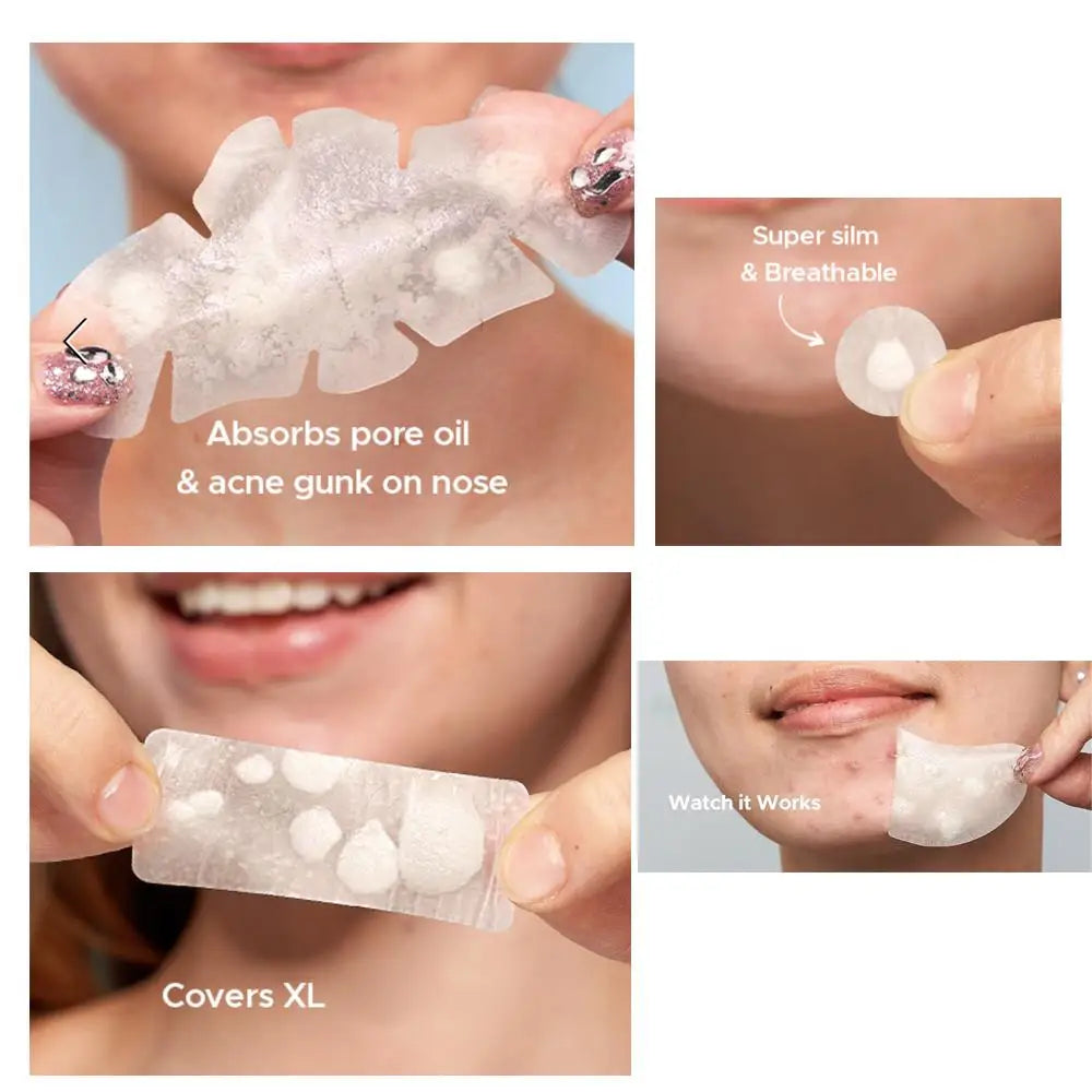 Large Hydrocolloid Pimple Patches for Face & Body – Strips & Dots