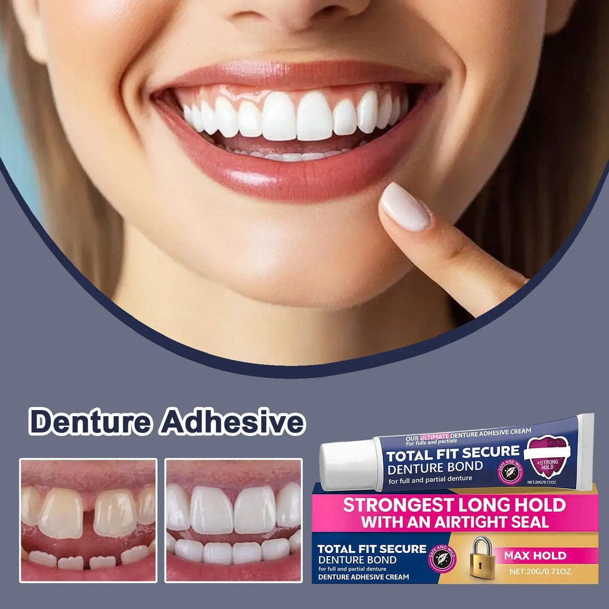 Denture Adhesive Cream – Long-Hold Secure Fit for Partials